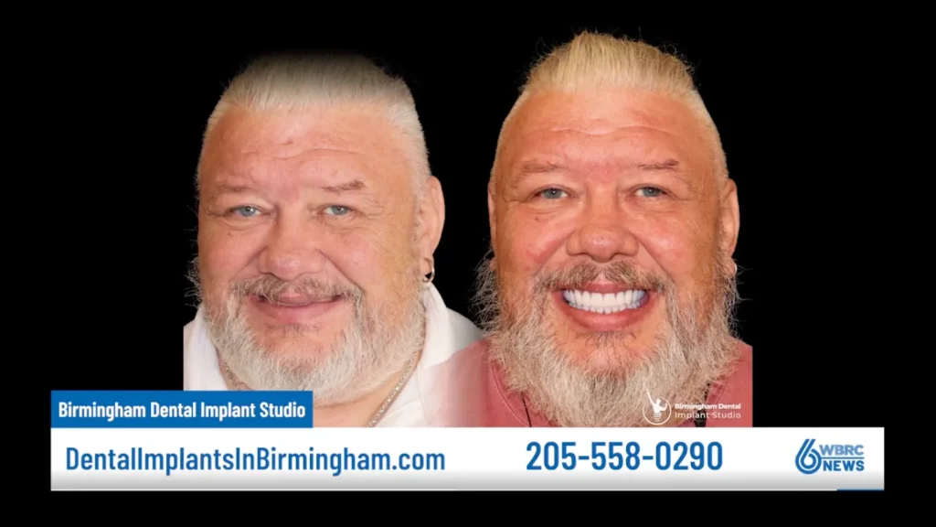 Dr. Laith Matalka from Birmingham Dental Implant Studio featured on "Ask the Expert!"