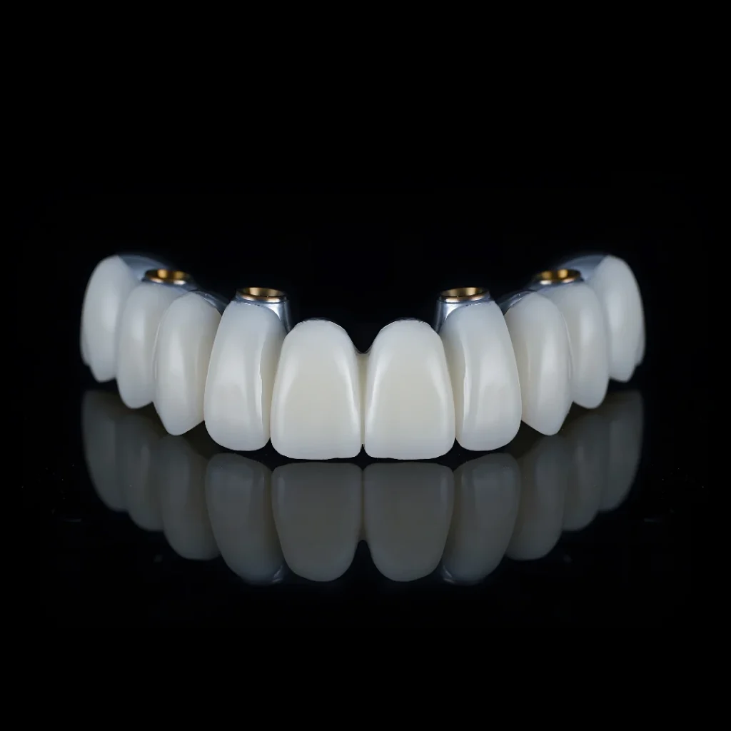 FP1 Zirconia teeth for All-On-4 dental implants in Birmingham, AL.