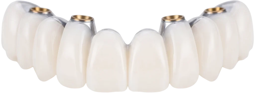 FP1 Zirconia teeth for All-On-X dental implants in Birmingham, AL.